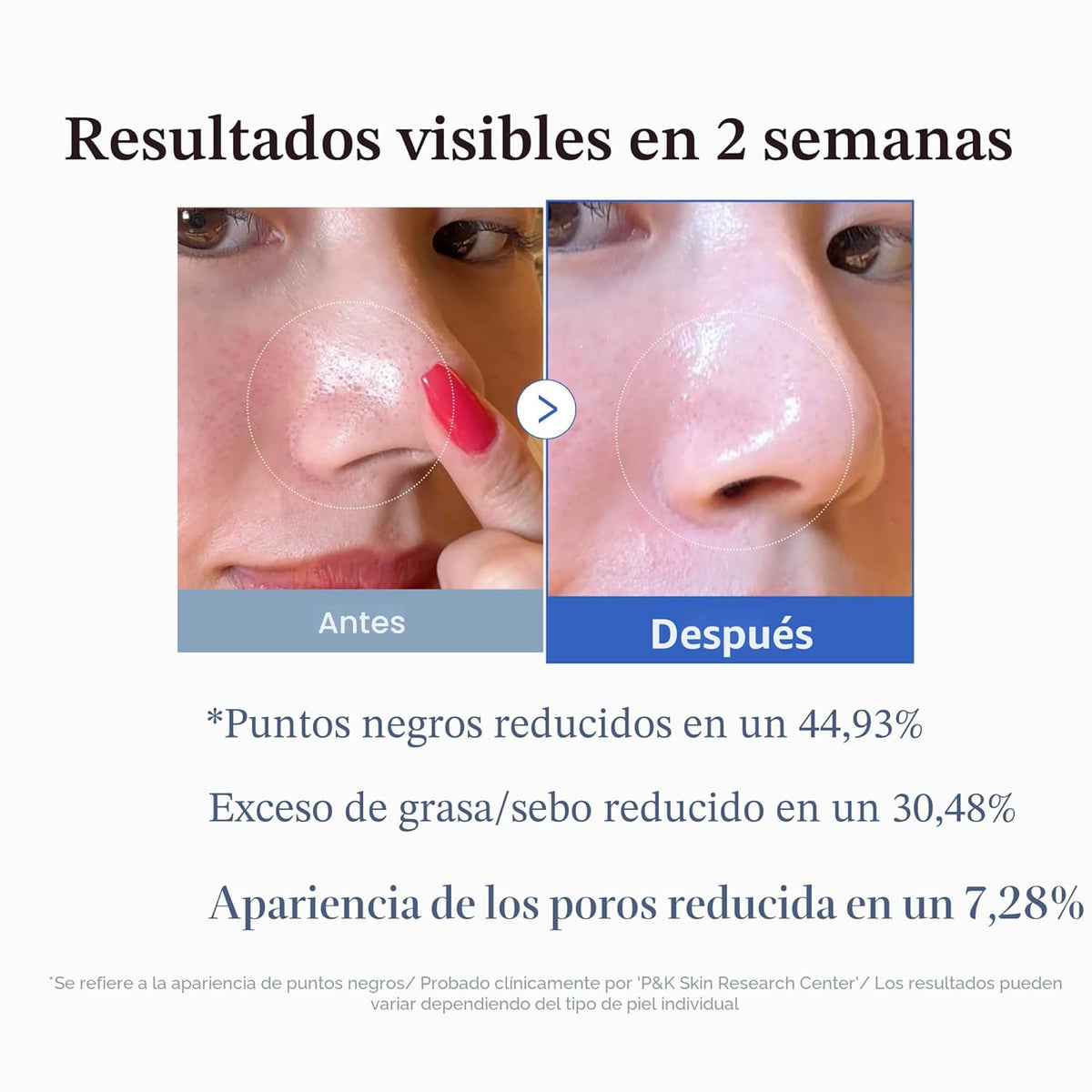 Medicube Zero Pore Pad – Almohadillas Exfoliantes para Minimizar Poros